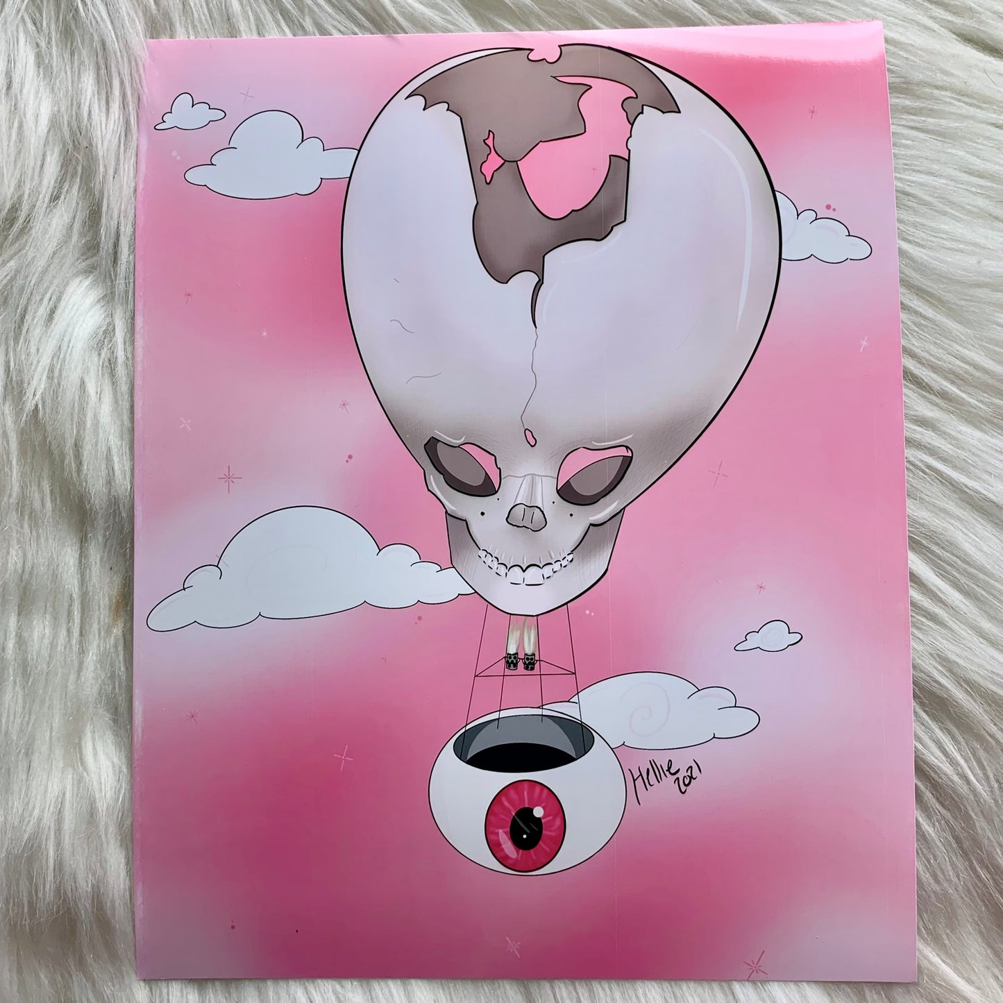 ‘hydrocephalus hot air balloon’ prints